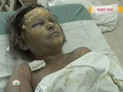 Ревнивый муж сжег жену на глазах у сына