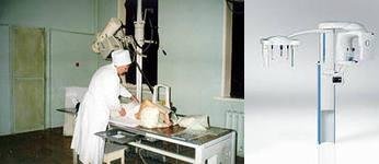 Сравнение ионизирующего луча в медицине.
